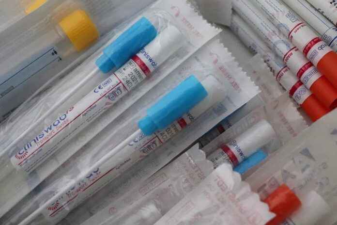 tamponi-test-coronavirs-covid-19