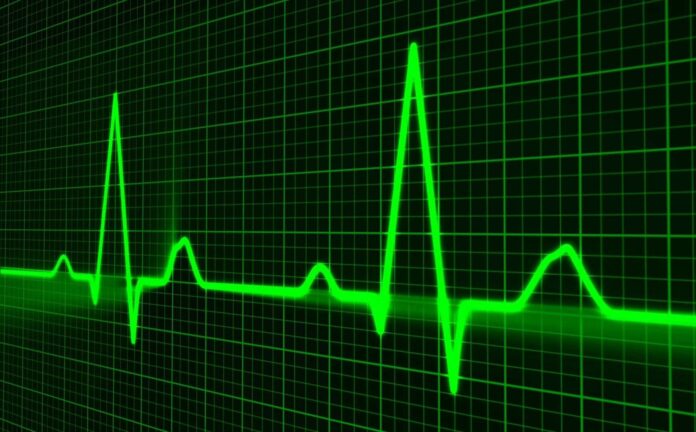 tracciato-cuore-impulso