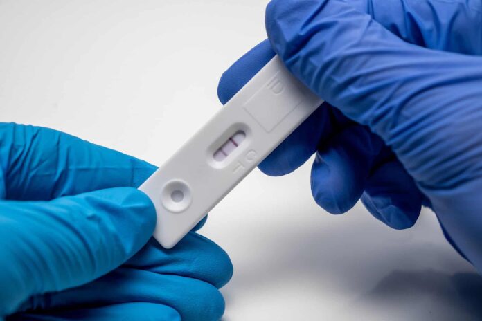 covid-coronavirus-test-rapido-tampone-positivo