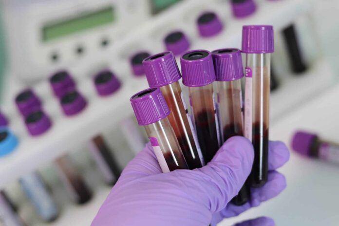 laboratorio-test-sangue-studio-medico-provette