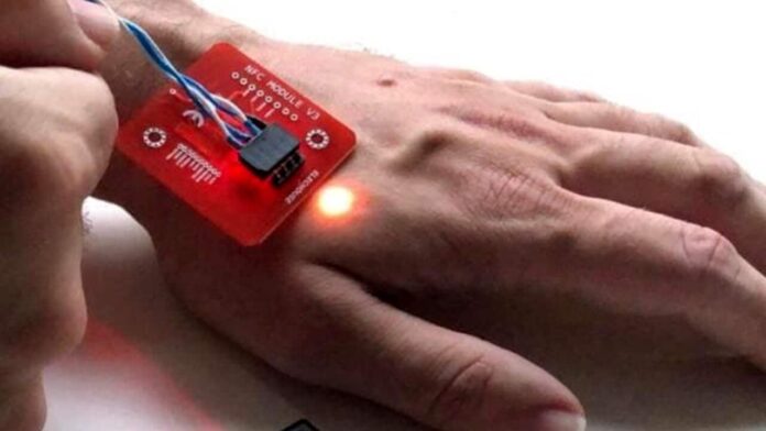Microchip sottopelle
